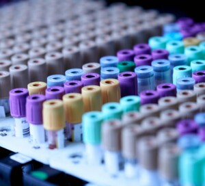 testalize-me-0jE8ynV4mis-unsplash